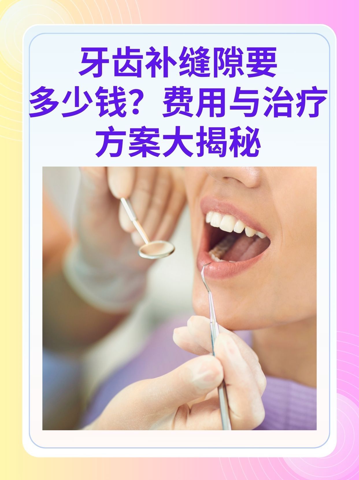 双鸭山补牙医保可以报销吗(补牙医保可以报销吗 哪些可以报销呢)